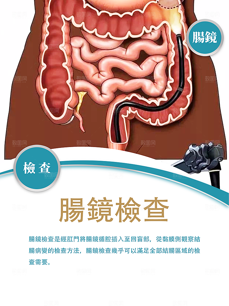 腸鏡檢查小图繁体字海报