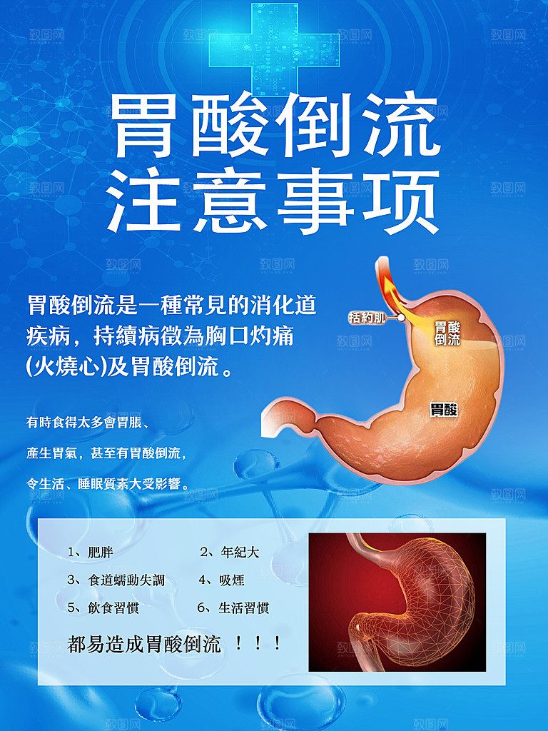 胃酸注意事项小图繁体字海报