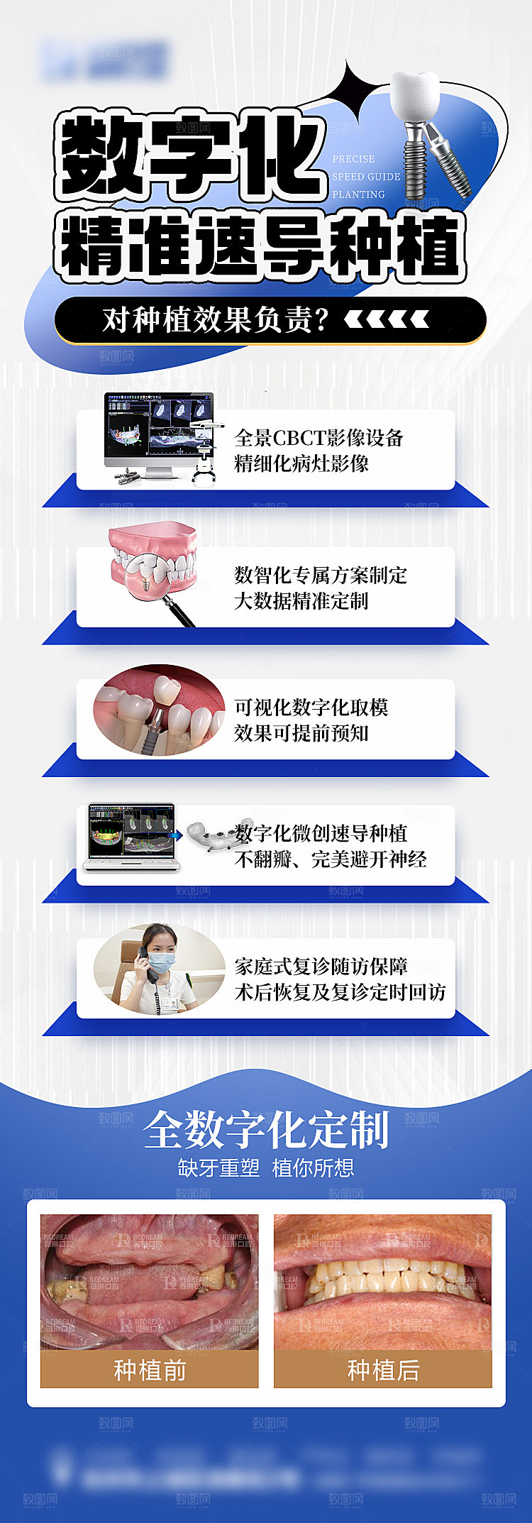 种植牙口腔类海报
