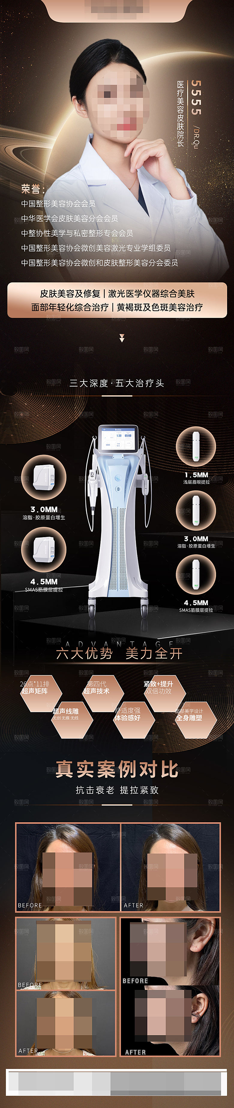医美美容铂金超声炮和专家介绍海报