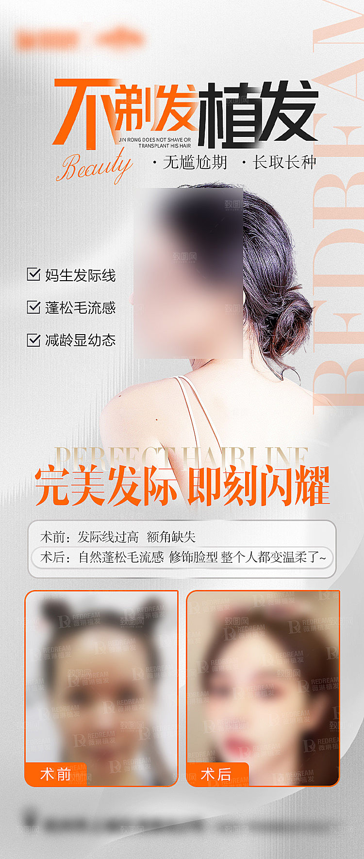 植发宣传海报设计