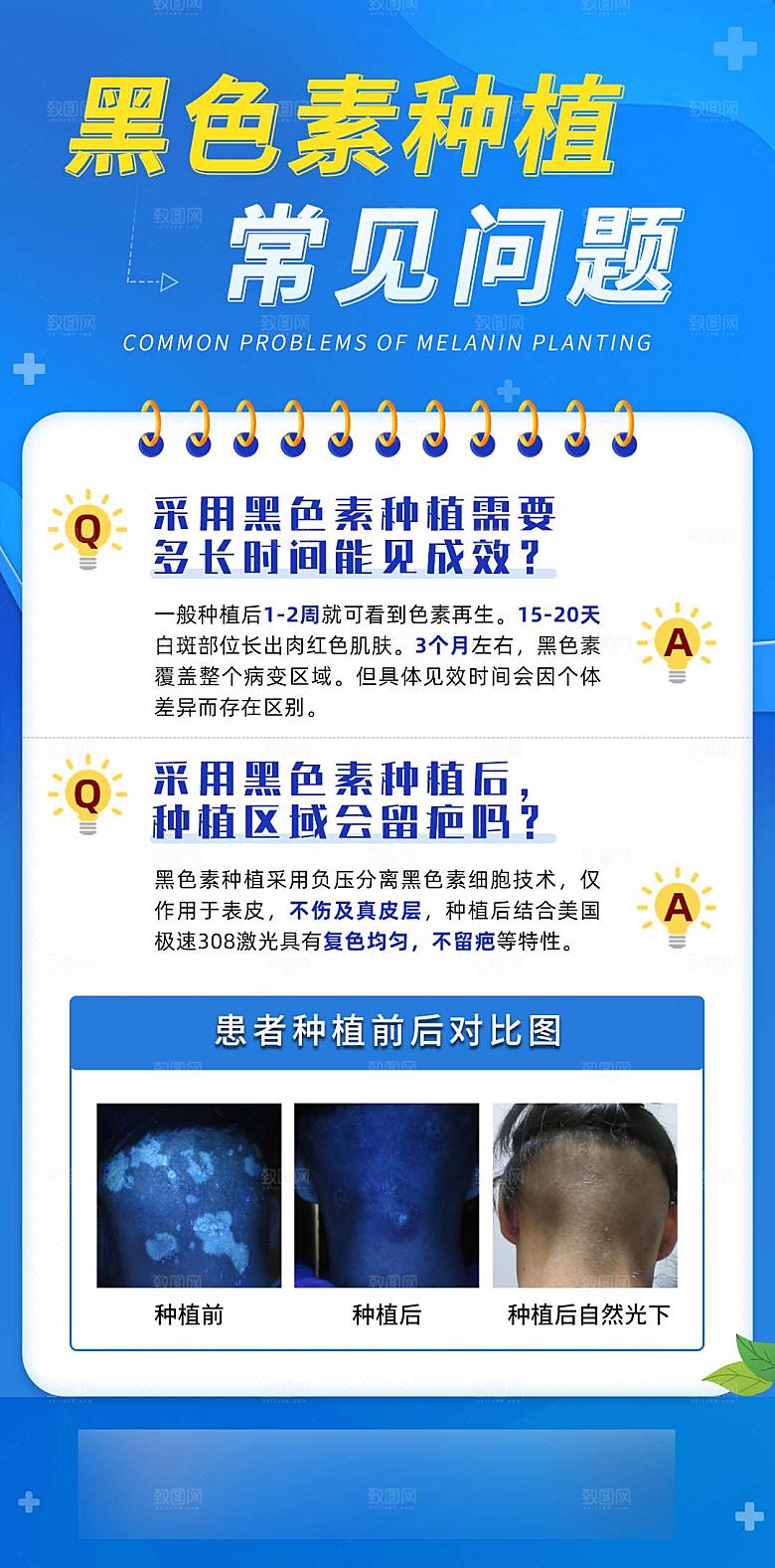 蓝色科普医疗常见问题知识科普渐变科普医用