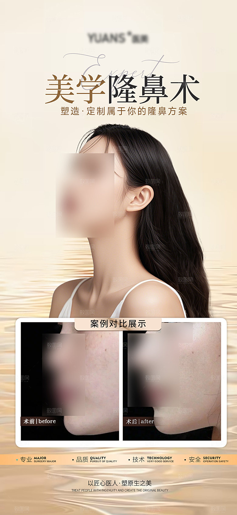 隆鼻医美案例海报设计