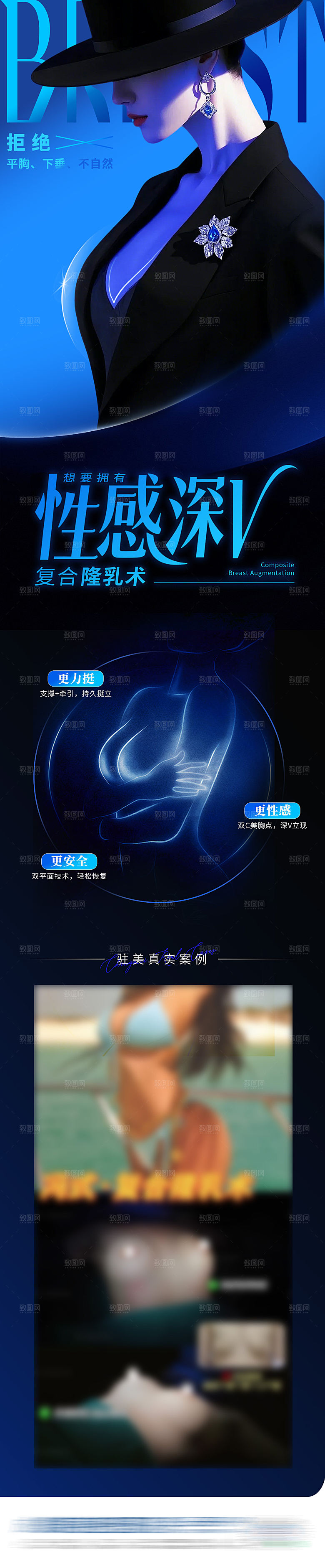医美美胸隆乳隆胸术案例创意长图海报