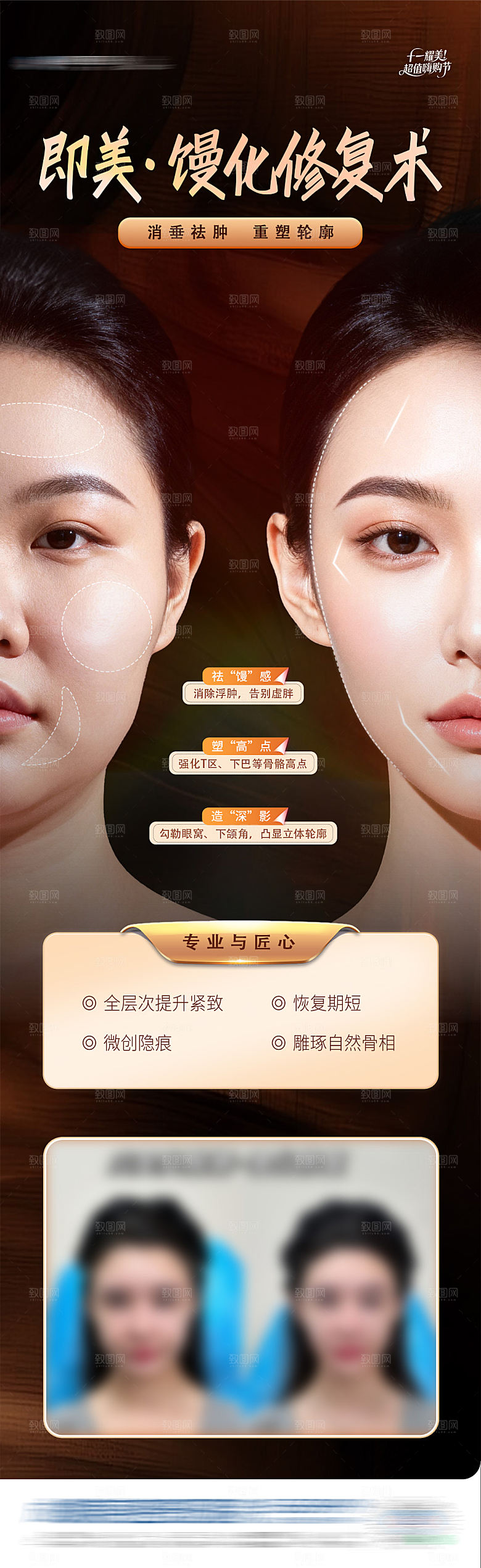 医美馒化脸修复案例对比创意长图海报