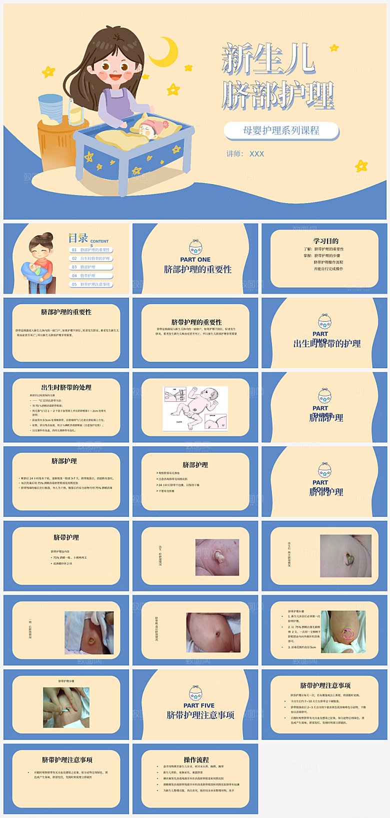 新生儿脐部护理治疗PPT模板