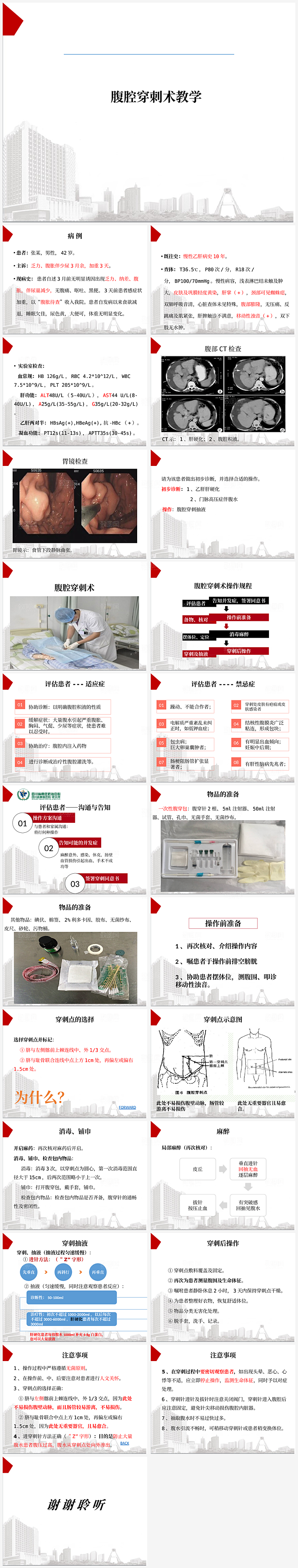 腹腔穿刺术教学PPT模板
